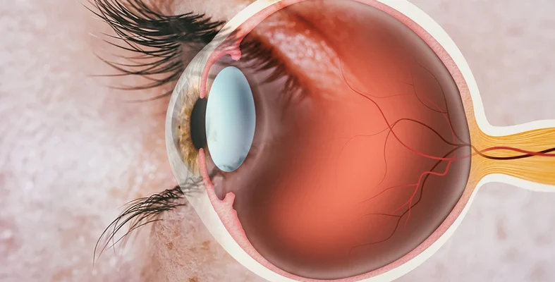 /عمليات زراعة الأنبوب داخل العين (علاج ضغط العين)